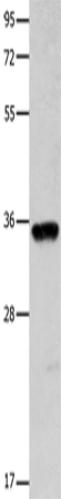 Western Blot analysis of Mouse brain tissue using COX11 Polyclonal Antibody at dilution of 1:600