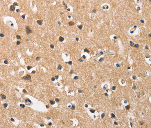 Immunohistochemistry of paraffin-embedded Human brain  using DKK3 Polyclonal Antibody at dilution of 1:50