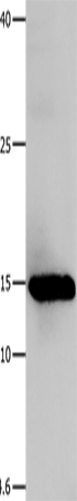 Western Blot analysis of Human fetal muscle tissue using Galectin 1 Polyclonal Antibody at dilution of 1:500