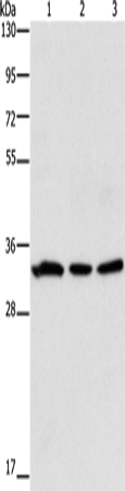 Western Blot analysis of 293T and Human colon cancer tissue, 231 cell using GPA33 Polyclonal Antibody at dilution of 1:600