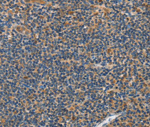 Immunohistochemistry of paraffin-embedded Human tonsil tissue using GRB7 Polyclonal Antibody at dilution 1:40