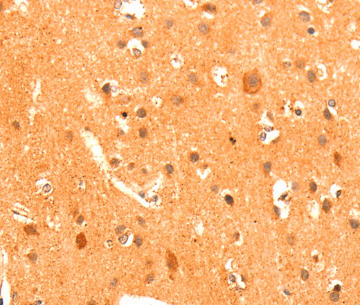 Immunohistochemistry of paraffin-embedded Human brain tissue using GRM3 Polyclonal Antibody at dilution 1:50