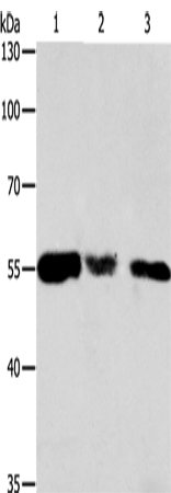 Western Blot analysis of Hela, 293T and NIH/3T3 cell using CALR Polyclonal Antibody at dilution of 1:500