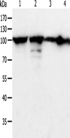 Western Blot analysis of Hela cell and Human liver cancer tissue, Jurkat and NIH/3T3 cell using HSP90B1 Polyclonal Antibody at dilution of 1:900