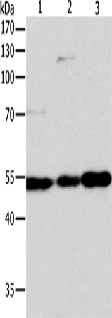 Western Blot analysis of Jurkat, Hela and A549 cell using GSR Polyclonal Antibody at dilution of 1:750