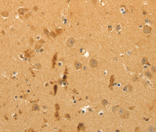 Immunohistochemistry of paraffin-embedded Human brain using CFHR1 Polyclonal Antibody at dilution of 1:40