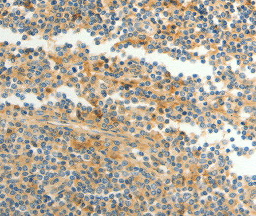 Immunohistochemistry of paraffin-embedded Human tonsil using CFHR1 Polyclonal Antibody at dilution of 1:40