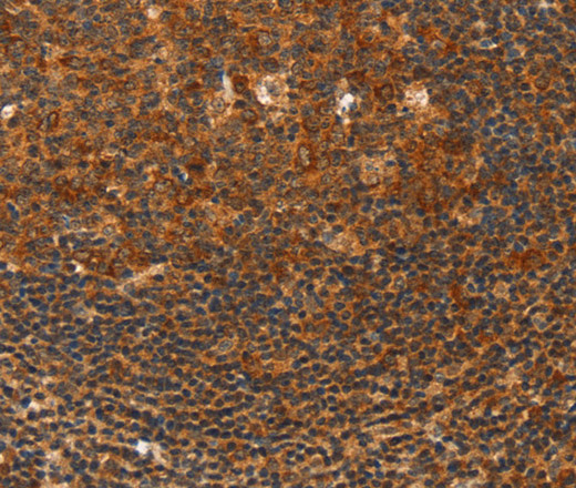 Immunohistochemistry of paraffin-embedded Human tonsil using HDAC8 Polyclonal Antibody at dilution of 1:40