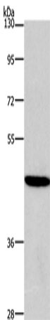 Western Blot analysis of 293T cell using HDAC8 Polyclonal Antibody at dilution of 1:950
