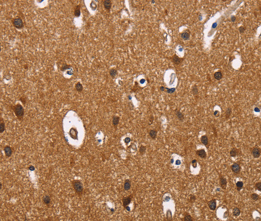 Immunohistochemistry of paraffin-embedded Human brain  using ILK Polyclonal Antibody at dilution of 1:60