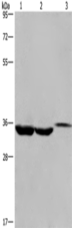 Western Blot analysis of Lovo cell,Human liver cancer tissue and Mouse kidney tissue using ING2 Polyclonal Antibody at dilution of 1:425