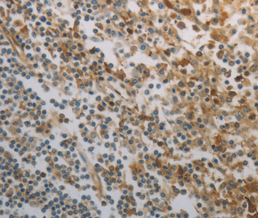 Immunohistochemistry of paraffin-embedded Human tonsil tissue using INHA Polyclonal Antibody at dilution 1:150