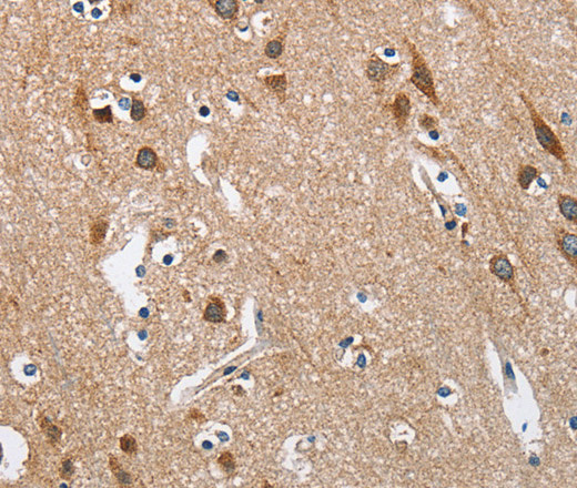 Immunohistochemistry of paraffin-embedded Human brain  tissue using KLF7 Polyclonal Antibody at dilution 1:40