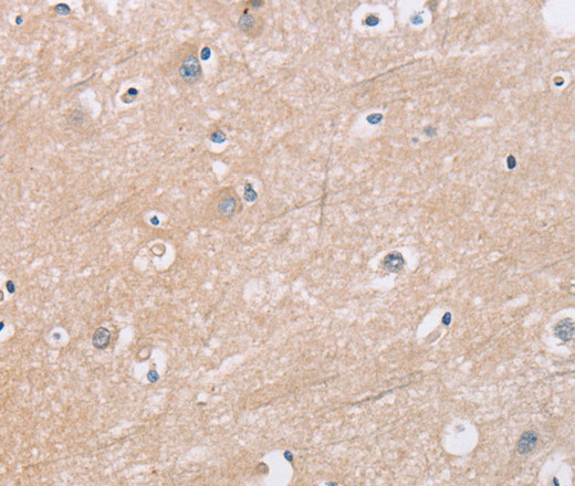 Immunohistochemistry of paraffin-embedded Human brain  tissue using KLK4 Polyclonal Antibody at dilution 1:40