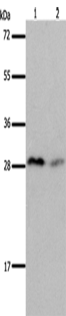 Western Blot analysis of Mouse brain and kidney tissue using KLK7 Polyclonal Antibody at dilution of 1:600