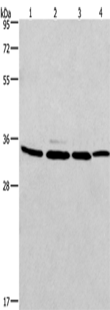 Western Blot analysis of A549, 231, PC3 and hela cell using MAD2L1BP Polyclonal Antibody at dilution of 1:675