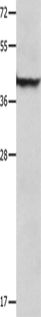 Western Blot analysis of Mouse lung tissue  using SERPINB5 Polyclonal Antibody at dilution of 1:1000