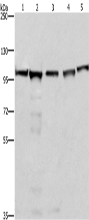 Western Blot analysis of 293T, A549, Raji, K562 and NIH/3T3 cell using MCM6 Polyclonal Antibody at dilution of 1:433.3