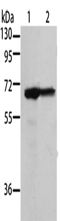 Western Blot analysis of 293T and A431 cell using MSN Polyclonal Antibody at dilution of 1:500