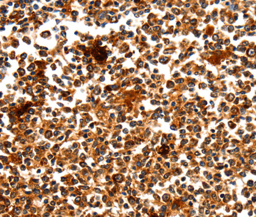 Immunohistochemistry of paraffin-embedded Human tonsil using MYOZ1 Polyclonal Antibody at dilution of 1:50