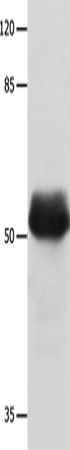 Western Blot analysis of Hela cell  using MUTYH Polyclonal Antibody at dilution of 1:500