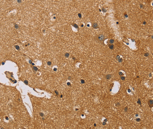 Immunohistochemistry of paraffin-embedded Human brain  using NRN1 Polyclonal Antibody at dilution of 1:50