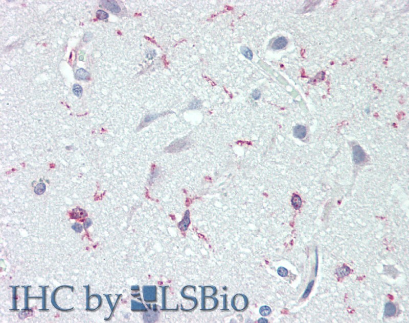 Immunohistochemistry of paraffin-embedded Human brain cortex  using NRN1 Polyclonal Antibody at dilution of 1:70.