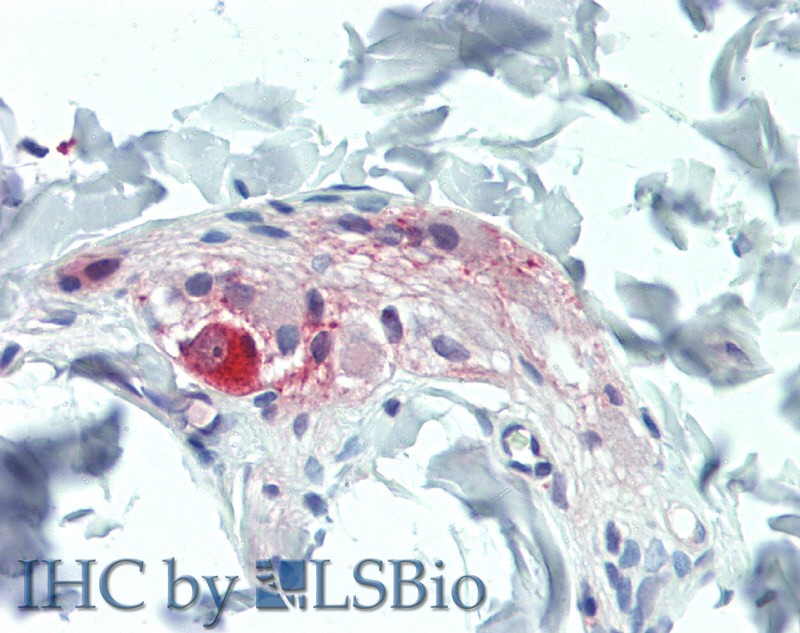 Immunohistochemistry of paraffin-embedded Colon, Submucosal Plexus tissue using TAC1 Polyclonal Antibody at dilution of 1:100.