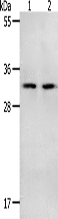 Western Blot analysis of Mouse spleen and intestinum crassum tissue using NME6 Polyclonal Antibody at dilution of 1:400