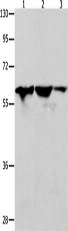 Western Blot analysis of Human seminoma tissue, HT-29 and A549 cell using DNAJC7 Polyclonal Antibody at dilution of 1:400