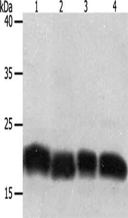 Western Blot analysis of Jurkat and hela cell, Human fetal lung tissue and A549 cell using PDCD6 Polyclonal Antibody at dilution of 1:200