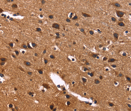 Immunohistochemistry of paraffin-embedded Human brain  using PHB Polyclonal Antibody at dilution of 1:40