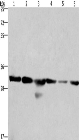 Western Blot analysis of 293T and A549 cell, Human hepatocellular carcinoma tissue and PC3 cell,hela cell and Mouse heart tissue using PHB Polyclonal Antibody at dilution of 1:500
