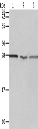 Western Blot analysis of Jurkat, A549 cell and Human fetal kidney tissue using PSMD9 Polyclonal Antibody at dilution of 1:750