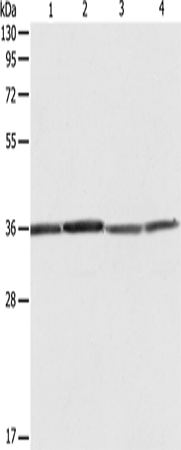 Western Blot analysis of Hela, 293T, A431 and Jurkat cell using RPLP0 Polyclonal Antibody at dilution of 1:600