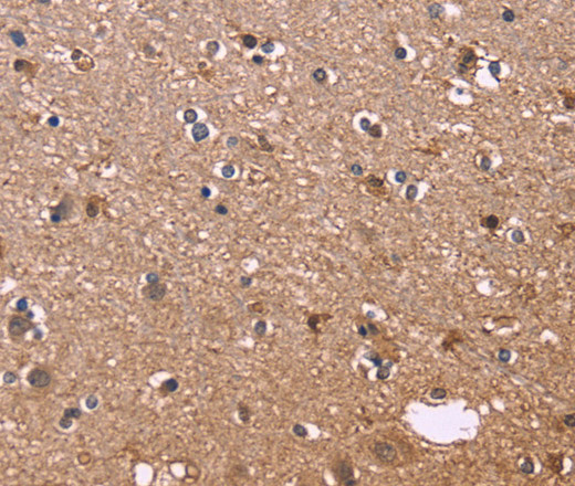 Immunohistochemistry of paraffin-embedded Human brain  tissue using S100A13 Polyclonal Antibody at dilution 1:40