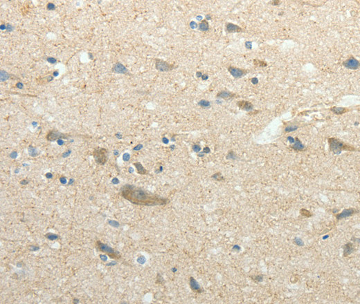 Immunohistochemistry of paraffin-embedded Human brain using SIRT3 Polyclonal Antibody at dilution of 1:30