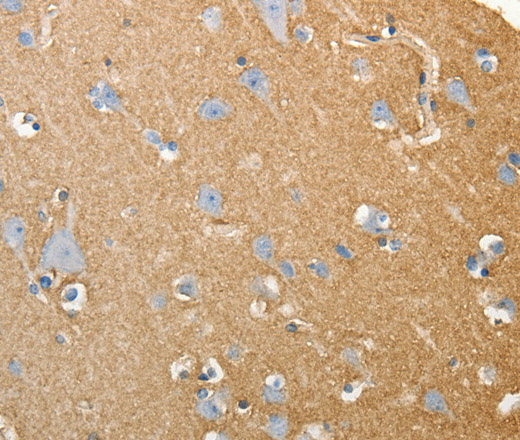 Immunohistochemistry of paraffin-embedded Human brain tissue using SLC4A4 Polyclonal Antibody at dilution 1:50