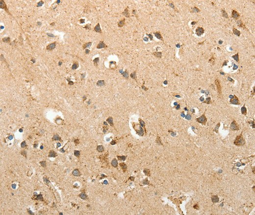 Immunohistochemistry of paraffin-embedded Human brain tissue using SLC12A4 Polyclonal Antibody at dilution 1:30