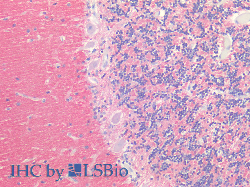 Immunohistochemistry of paraffin-embedded Human Brain using SNAP25 Polyclonal Antibody at dilution of 1:100.