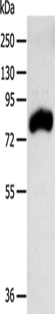 Western Blot analysis of Mouse kidney tissue using RPAP3 Polyclonal Antibody at dilution of 1:400