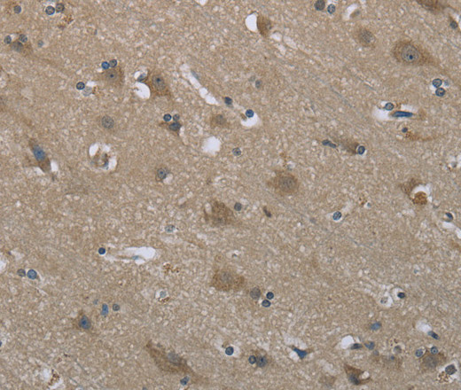 Immunohistochemistry of paraffin-embedded Human brain tissue using SYT3 Polyclonal Antibody at dilution 1:50