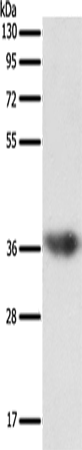 Western Blot analysis of Human liver cancer tissue using SULT1E1 Polyclonal Antibody at dilution of 1:500