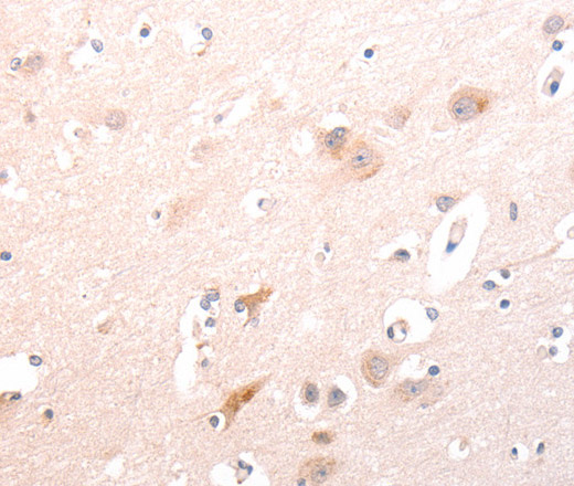 Immunohistochemistry of paraffin-embedded Human brain using TRAF3IP1 Polyclonal Antibody at dilution of 1:70