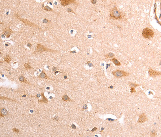 Immunohistochemistry of paraffin-embedded Human brain tissue using TRPV4 Polyclonal Antibody at dilution 1:40