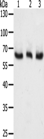 Western Blot analysis of A375, Hela and Jurkat cell using TYR Polyclonal Antibody at dilution of 1:400