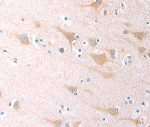 Immunohistochemistry of paraffin-embedded Human brain tissue using SCGB1A1 Polyclonal Antibody at dilution 1:60