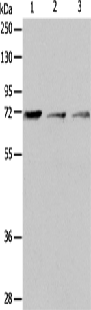 Western Blot analysis of RAW264.7 cell and Human liver cancer tissue, SP20 cell using CD218b Polyclonal Antibody at dilution of 1:650