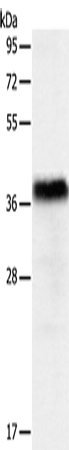 Western Blot analysis of Human liver cancer tissue using PGBD2 Polyclonal Antibody at dilution of 1:550