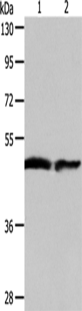 Western Blot analysis of Human fetal liver and liver cancer tissue using AADAC Polyclonal Antibody at dilution of 1:550